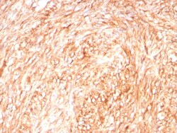 CD117/c-kit Antibody (C117/8879R), Novus Biologicals&trade;