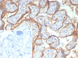 Glypican 3 Antibody (GPC3/7991R), Novus Biologicals:Antibodies:Primary