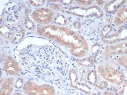 GCLM Antibody (GCLM/4068), Novus Biologicals 100 &mu;g, Unconjugated:Antibodies,