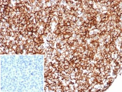 CD35 Antibody (rCR1/8600), Novus Biologicals:Antibodies:Primary Antibodies