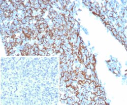 CD35 Antibody (CR1/8244R), Novus Biologicals:Antibodies:Primary Antibodies