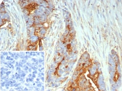 MUC1 Antibody (MUC1/7797R), Novus Biologicals 20 &mu;g, Unconjugated:Antibodies,