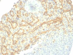 TIM-3 Antibody (TIM3/6863R), Novus Biologicals 100 &mu;g, Unconjugated:Anticuerpos