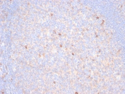 TIM-3 Antibody (TIM3/6863R), Novus Biologicals 100 &mu;g, Unconjugated:Anticuerpos