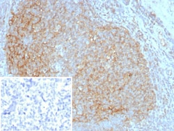 CD35 Antibody (CR1/8283R), Novus Biologicals 20 &mu;g, Unconjugated:Antibodies,