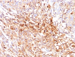 ABCC11 Antibody (ABCC11/2438), Novus Biologicals:Anticorps:Anticorps primaires