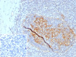 CD35 Antibody (CR1/8284R), Novus Biologicals 100 &mu;g, Unconjugated:Antibodies,