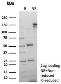 dsDNA Antibody (rDSD/8266), Novus Biologicals 20 &mu;g, Unconjugated:Anticuerpos