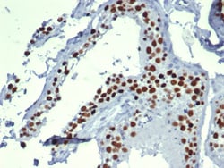 MCM3 Antibody (MCM3/6706), Novus Biologicals:Antibodies:Primary Antibodies