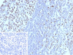 MCM3 Antibody (MCM3/8972R), Novus Biologicals 20 &mu;g, Unconjugated:Antibodies,