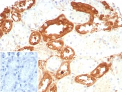 GSTM3 Antibody (rGSTM3/8878), Novus Biologicals 20 &mu;g, Unconjugated:Antibodies,