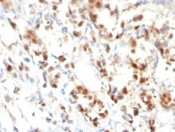 Progesterone R/NR3C3 Antibody (PGR/8099R), Novus Biologicals:Antibodies:Primary