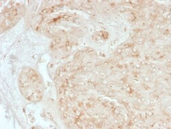 StAR Antibody (STAR/3976) - Azide and BSA Free, Novus Biologicals 100 &mu;g,