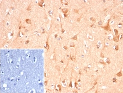 Adenylate Cyclase 8 Antibody (ADCY8/7341) - Azide and BSA Free, Novus Biologicals