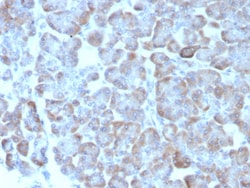 Adenylate Cyclase 8 Antibody (ADCY8/7573) - Azide and BSA Free, Novus Biologicals