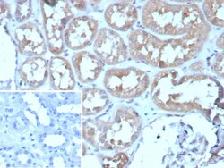Adenylate Cyclase 8 Antibody (ADCY8/7573) - Azide and BSA Free, Novus Biologicals