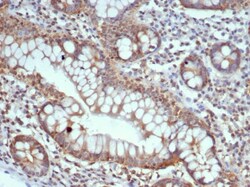 S100G Antibody (S100G/7516) - Azide and BSA Free, Novus Biologicals 100