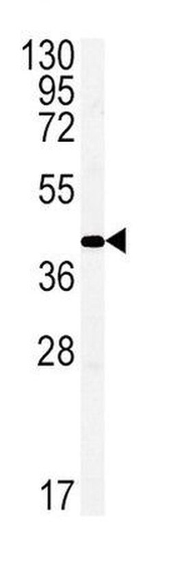 Connexin 43/GJA1 Antibody, Novus Biologicals 400 &mu;L, Unconjugated:Antibodies,