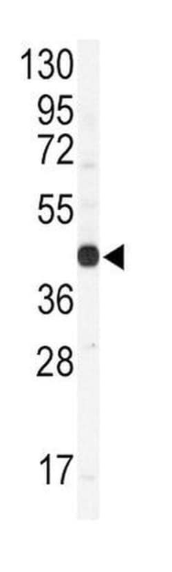 Connexin 43/GJA1 Antibody, Novus Biologicals 400 &mu;L, Unconjugated:Antibodies,