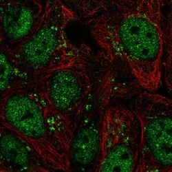 Pyrroline-5-Carboxylate Reductase Antibody, Novus Biologicals 100 &mu;L,