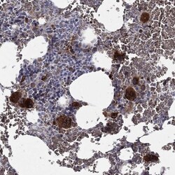 Cathepsin W Antibody, Novus Biologicals 100 &mu;L, Unconjugated:Antibodies,