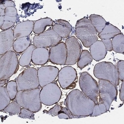 Caveolin-3 Antibody, Novus Biologicals 100 &mu;L, Unconjugated:Antibodies,