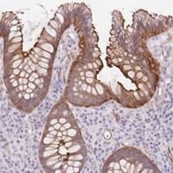 Ccd1/DIXDC1 Antibody, Novus Biologicals 100 &mu;L, Unconjugated:Antibodies,
