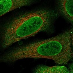 CCDC110 Antibody, Novus Biologicals 100 &mu;L, Unconjugated:Antibodies,