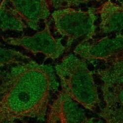 CCK-AR Antibody, Novus Biologicals 100 &mu;L, Unconjugated:Antibodies,