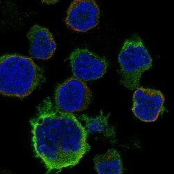 CCR2 Antibody, Novus Biologicals 100 &mu;L, Unconjugated:Antibodies, Polyclonal