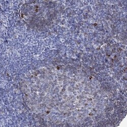 CD79A Antibody, Novus Biologicals 100 &mu;L, Unconjugated:Antibodies, Polyclonal