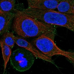 Cholecystokinin-B R/CCKBR Antibody, Novus Biologicals 100 &mu;L, Unconjugated:Antibodies,