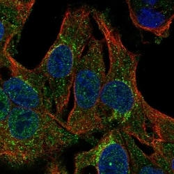Claudin-20 Antibody, Novus Biologicals 100 &mu;L, Unconjugated:Antibodies,