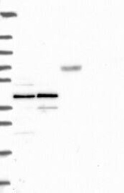 CPNE1 Antibody, Novus Biologicals 100 &mu;L, Unconjugated:Antibodies, Polyclonal