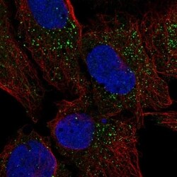 CRISPLD2 Antibody, Novus Biologicals 100 &mu;L, Unconjugated:Antibodies,