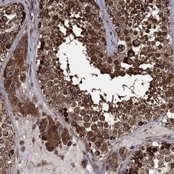 CYLD Antibody, Novus Biologicals 100 &mu;L, Unconjugated:Antibodies, Polyclonal