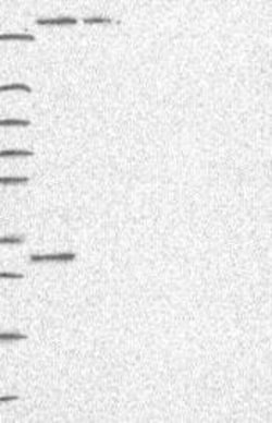 CYLD Antibody, Novus Biologicals 100 &mu;L, Unconjugated:Antibodies, Polyclonal