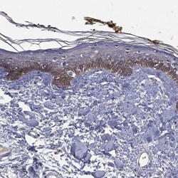 Desmoglein-4 Antibody, Novus Biologicals 100 &mu;L, Unconjugated:Antibodies,