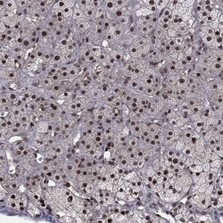 DMAP1 Antibody, Novus Biologicals 100 &mu;L, Unconjugated:Antibodies, Polyclonal