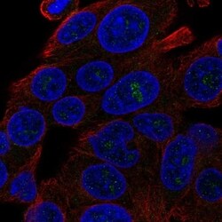 DQX1 Antibody, Novus Biologicals 100 &mu;L, Unconjugated:Antibodies, Polyclonal