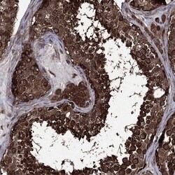 eIF2B4 Antibody, Novus Biologicals 100 &mu;L, Unconjugated:Antibodies,