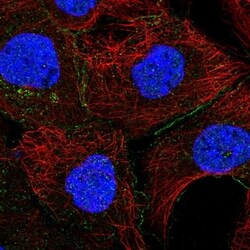 Eps8 Antibody, Novus Biologicals 100 &mu;L, Unconjugated:Antibodies, Polyclonal