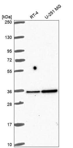 Fructosamine-3-kinase-related Antibody, Novus Biologicals 100 &mu;L, Unconjugated:Antibodies,