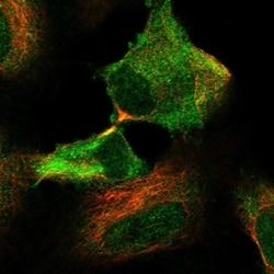 Glutathione Peroxidase 2/GPX2 Antibody, Novus Biologicals 100 &mu;L, Unconjugated:Antibodies,