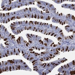 IGFBP-6 Antibody, Novus Biologicals 100 &mu;L, Unconjugated:Antibodies,