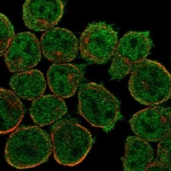 IGFLR1/TMEM149 Antibody, Novus Biologicals 100 &mu;L | Buy Online | Novus Biologicals | Fisher Scientific