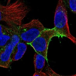 IL-11R alpha Antibody, Novus Biologicals 100 &mu;L, Unconjugated:Antibodies,