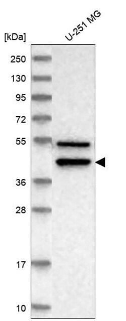 IL-11R alpha Antibody, Novus Biologicals 100 &mu;L, Unconjugated:Antibodies,