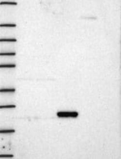 KRAS Antibody, Novus Biologicals 100 &mu;L, Unconjugated:Antibodies, Polyclonal