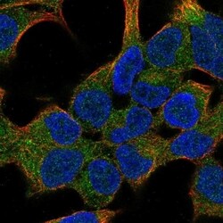 KRAS Antibody, Novus Biologicals 100 &mu;L, Unconjugated:Antibodies, Polyclonal